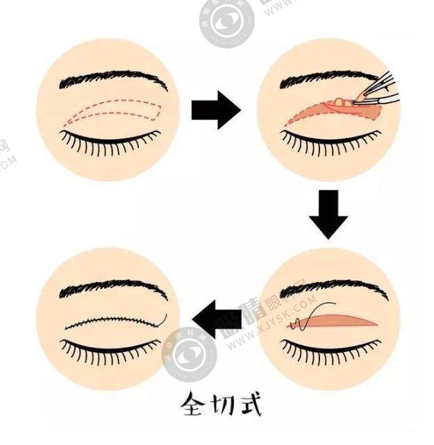 杜园园医生到底难不难预约？眼整形金刀奖评委实力揭秘及快捷预约方法大公开！