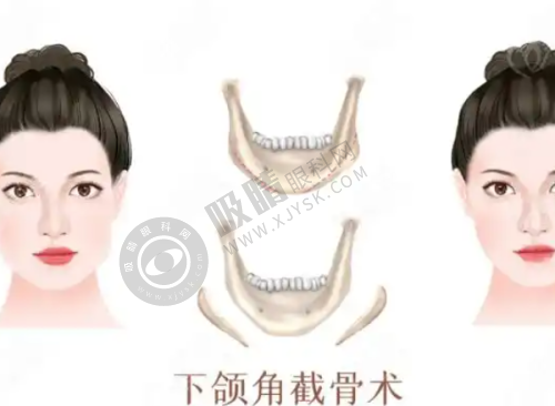 3. 深圳鹏爱秀琪医疗美容医院——注重整体皮肤健康的祛疤医院
