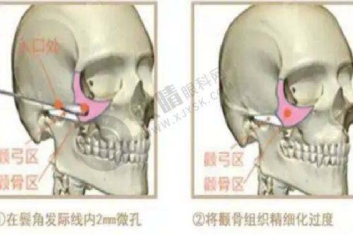 3. 洛阳谢景良医疗美容门诊部：提供多样特色服务