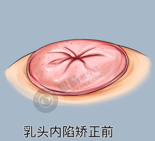 10. 成都军大——级创伤修复技术,外院失败拯救骨干医生