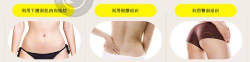 9. 洛阳班爱荣医疗美容诊所:紧致提升与果酸焕肤特色