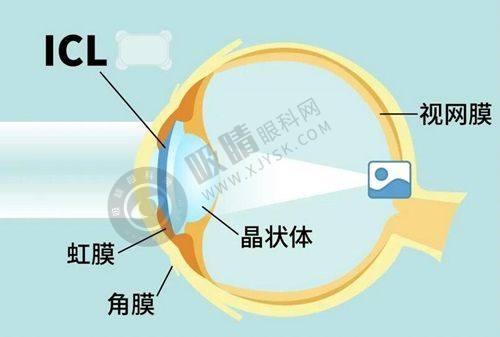 2025铜梁爱尔眼科：透明价目+尖端技术，守护您的清晰视界！
