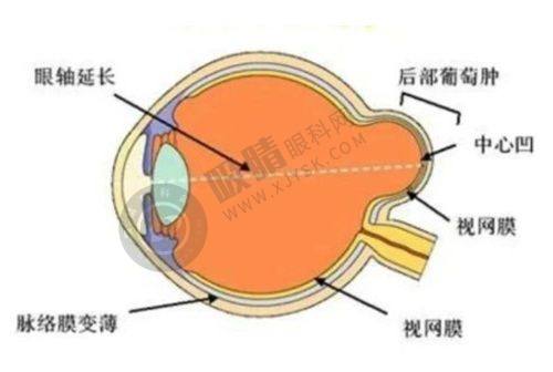 患者选择乌鲁木齐474空军眼科的理由