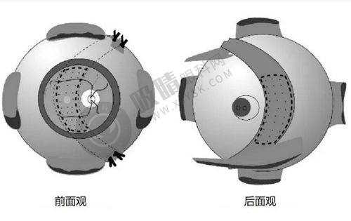 全飞秒1.8万价格全方面评估