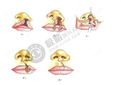 2. 东阳俪芙美打造微笑唇的团队怎么样？