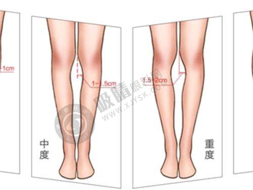 4. 义乌连天美的收费情况怎样?