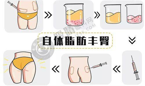 浙江金华丽都整形口碑如何？11项专利技术、高双眼皮满意度，真实案例揭秘！