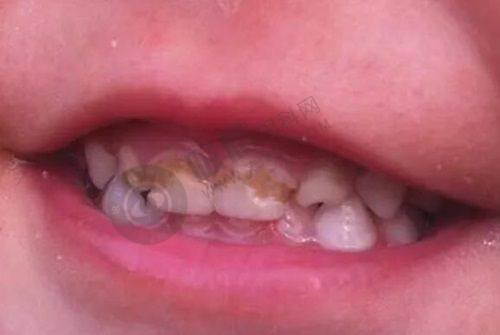 杭州薇琳口腔医院设备与技术怎么样？