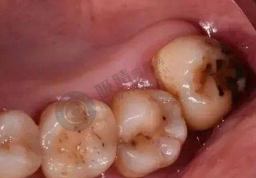 杭州薇琳口腔医院医生团队水平高吗？