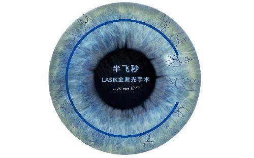 杭州未来科技城医院眼科口碑如何？全飞秒1.68万起、ICL晶体植入2.6万起，专业团队实力解析！