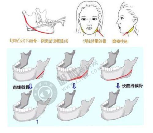 杭州萧山艺然美医疗美容靠谱吗？破产清算前鼻综合+眼部修复技术解析，李长江医生案例实拍！