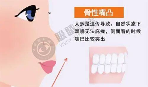 3. 杭州萧山艺然美医疗美容门诊部的眼部修复技术怎么样？