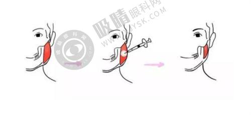 3. 浙江金华永康臻蓉颜医疗美容的合规性如何？