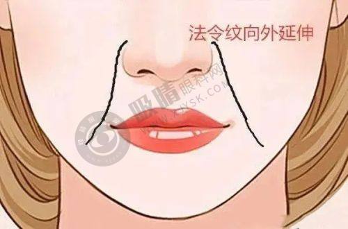 杭州中瑞联合医疗美容正规吗？资质齐全+国际设备，双眼皮3000起效果惊艳！