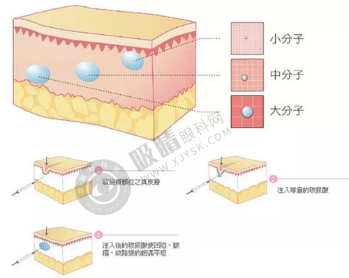 浙江金华橘里医疗美容靠谱吗？徐院长修复隆鼻口碑爆棚，双眼皮3800元起效果惊艳！