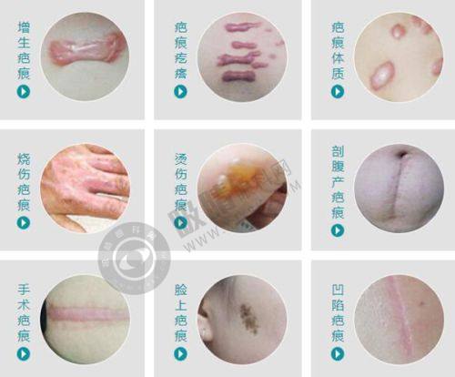 2. 浙江湖州安吉管愿愿医美的医生技术如何？