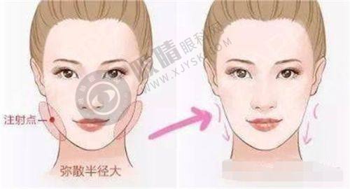 2. 温州芘丽芙整形医院的技术和设备有什么优势?