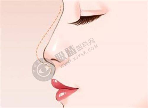 3. 义乌阳光美容医院的技术设备有优势吗？