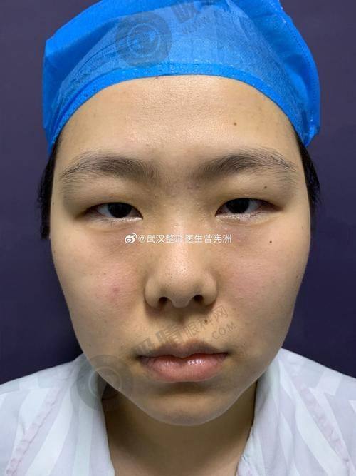 3. 湖州恒颜美整形的价格贵吗？