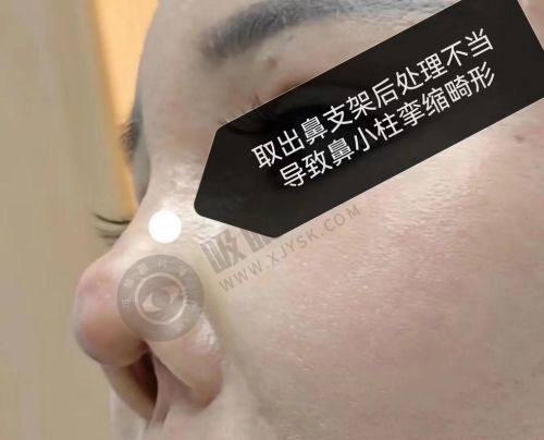 4. 湖州恒颜美整形的服务和环境如何？