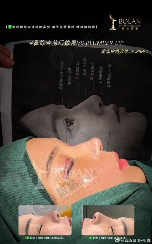 2. 衢州桂美人整形的技术优势体现在哪？