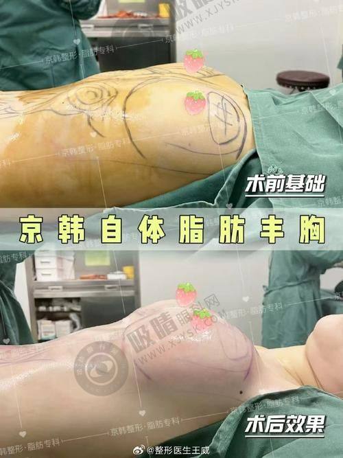 浙江台州艺星医疗美容医院口碑如何？6D明星眼+BSK宫廷隆鼻真实案例分享，专业医生团队打造精致美颜！