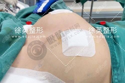 2. 湖州恒颜美整形的技术和设备怎么样？