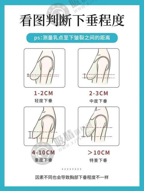 2. 绍兴维美整形在植发技术上有什么优势？
