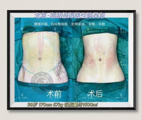 4. 浙江湖州爱尚美医疗美容的服务和环境怎么样？