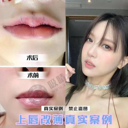 3. 东阳俪芙美除了微笑唇还开展哪些医美项目？