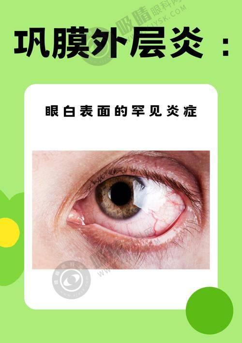 2. 江门光明眼科医院核心优势