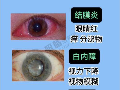 重庆爱成眼科医院