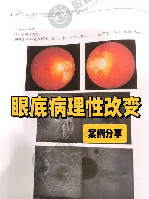 6. 成都双楠医院眼科交通指南