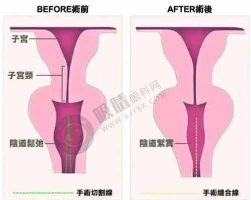 5. 浙江诸暨西子美整形医院价格