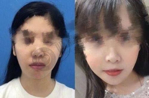 5. 浙江金华东阳俪芙美医疗美容医院价格