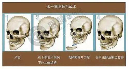 金华玥莱美医疗美容医院