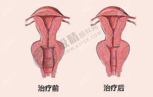 5. 浙江省义乌阳光美容医院价格