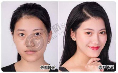 2025惠州十大整形医院权威推荐：高性价比榜单新鲜出炉