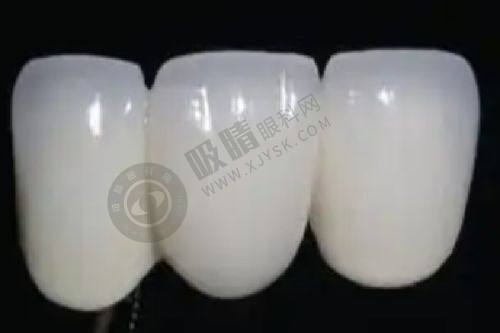 慈溪牙科医院价格表