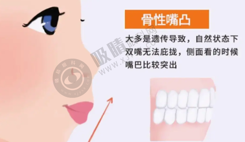 宜兴矫正牙齿收费标准