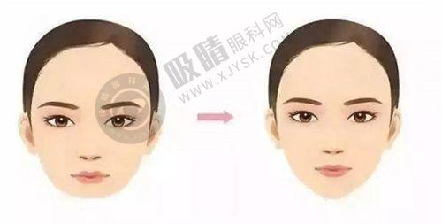 3. 浙江金华显赫（原玥莱美）植发专科医资力量