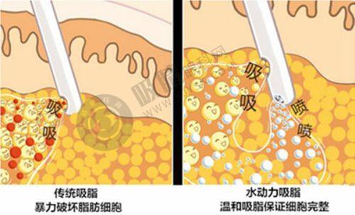 5. 浙江宁波美莱整形医院价格