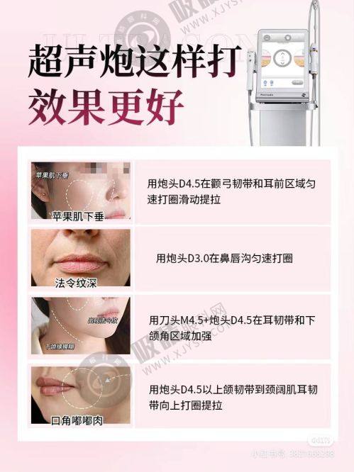 2. 浙江宁波美莱整形医院核心优势