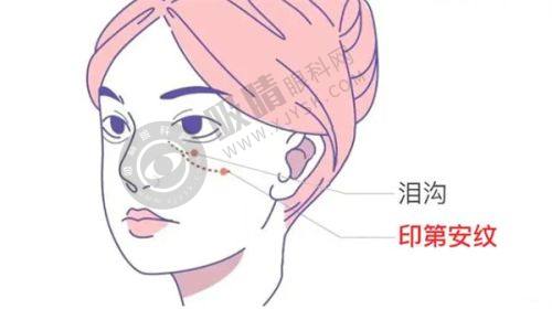 深圳祛眼袋收费标准
