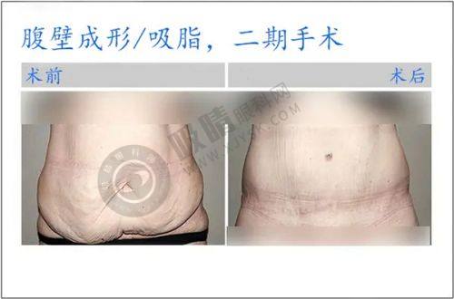 4. 浙江杭州华美禧善医疗美容医院特色项目