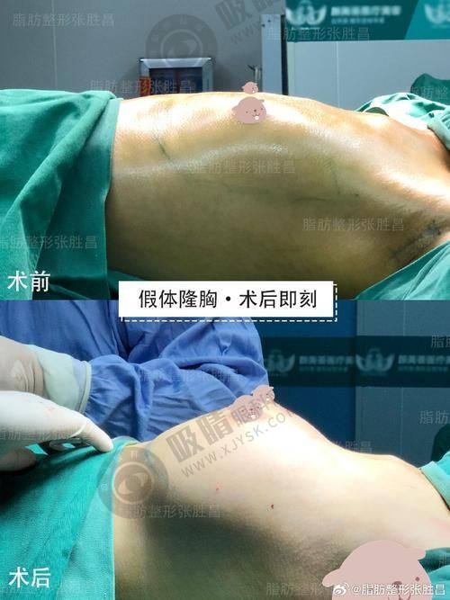杭州维多利亚整形医院正规吗？17项专项技术、四级资质认证，明星同款微整形首选！