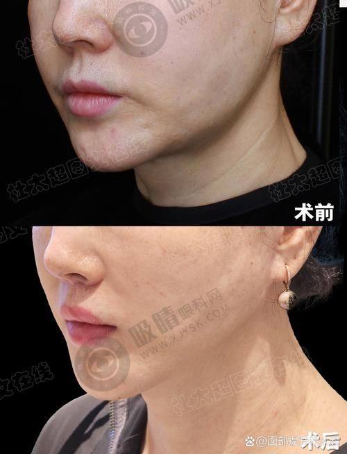 杭州维多利亚整形医院的行业地位如何体现？