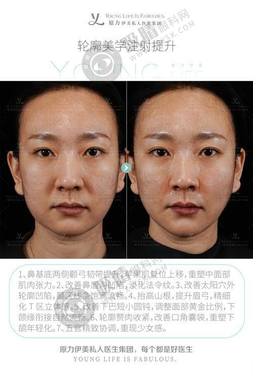 去杭州维多利亚整形医院求美有保护吗？