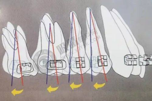 北京劲松口腔医院种牙多少钱？13家分院任选+20年经验+高端设备保障，种牙无忧！