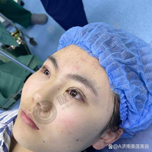 2. 温州瑞安刘宏伟医美诊所口碑如何？